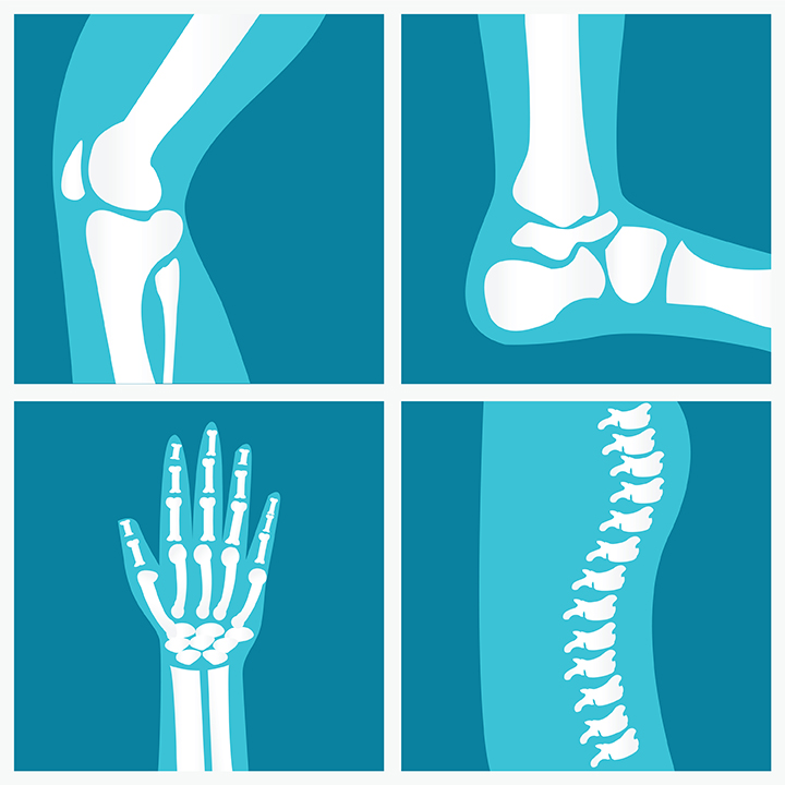 x-rays of knee, hand, foot and spine